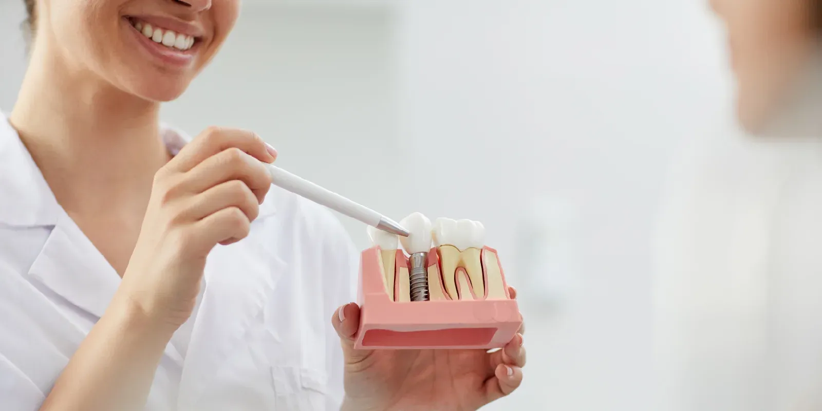 Common Myths About Dental Implants Patients Should Know 