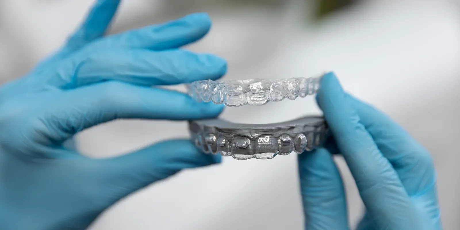 How Accurate Are Invisalign Results? A Look at Predictability and Precision