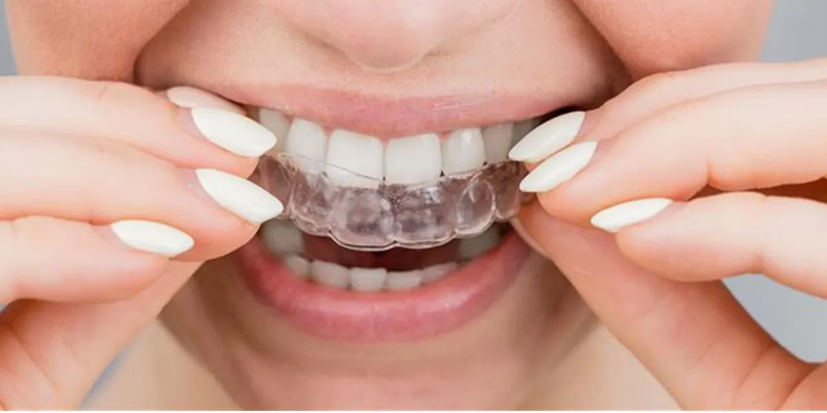 Invisalign Retainers: Why Post-Treatment Maintenance Is Crucial